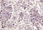 CTR1 Polyclonal Antibody