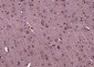 KIF5A/NKHC1 Polyclonal Antibody