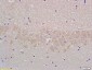 VGLUT1/BNP1 Polyclonal Antibody