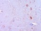 VGLUT1/BNP1 Polyclonal Antibody