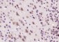 Microcephalin 1/BRIT1 Polyclonal Antibody