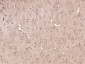 RAB10 Polyclonal Antibody