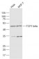 TCP1 beta Polyclonal Antibody
