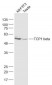 TCP1 beta Polyclonal Antibody