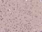 TCP1 beta Polyclonal Antibody