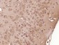 SPAG16 Polyclonal Antibody