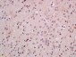 FOXB1 Polyclonal Antibody