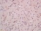 FOXB1 Polyclonal Antibody