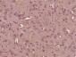 Gemin 1 Polyclonal Antibody