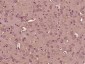 Gemin 1 Polyclonal Antibody