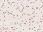 Gemin 2 Polyclonal Antibody