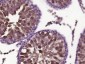 Gli3 Polyclonal Antibody