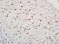 ACAN Polyclonal Antibody