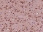 ACAN Polyclonal Antibody