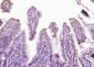 NPEPPS Polyclonal Antibody