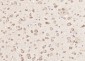 GMF beta Polyclonal Antibody