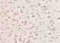 GMF beta Polyclonal Antibody