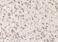 GMF beta Polyclonal Antibody