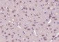 MEIS2 Polyclonal Antibody