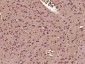 PTBP2 Polyclonal Antibody