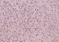 SRPX2 Polyclonal Antibody