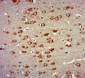 ZNF346 Polyclonal Antibody