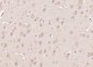 NAC1 Polyclonal Antibody