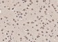 SOX1 Polyclonal Antibody