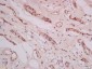 THEMIS Polyclonal Antibody