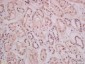 THEMIS Polyclonal Antibody