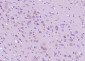 APC10 Polyclonal Antibody