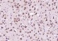 ARF5 Polyclonal Antibody