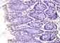 ABH1 Polyclonal Antibody