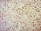 SMG1 Polyclonal Antibody