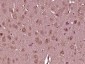 TMEM85 Polyclonal Antibody