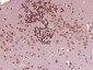 ZNF496 Polyclonal Antibody
