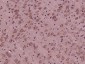 STCH/HSPA13 Polyclonal Antibody