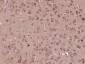 STIM2 Polyclonal Antibody