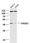 STK32C Polyclonal Antibody