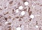 Cytohesin 2 Polyclonal Antibody