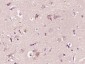 CTRP2 Polyclonal Antibody
