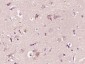 CTRP2 Polyclonal Antibody