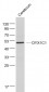 DYX1C1 Polyclonal Antibody