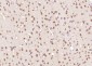 DYX1C1 Polyclonal Antibody