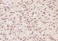 DYX1C1 Polyclonal Antibody