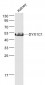 DYX1C1 Polyclonal Antibody