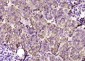 EHM2 Polyclonal Antibody