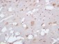 EXOC2 Polyclonal Antibody