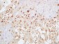 EXOC2 Polyclonal Antibody
