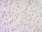EXOSC7 Polyclonal Antibody